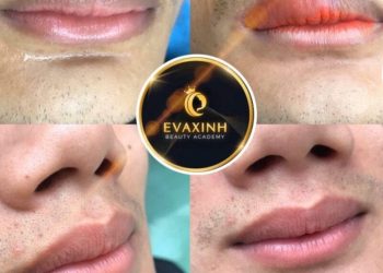 cách trị môi thâm đen