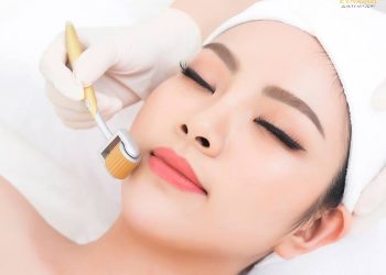 chăm sóc da sau phi kim trị mụn