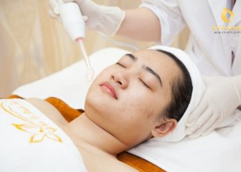 có nên đi nặn mụn ở spa